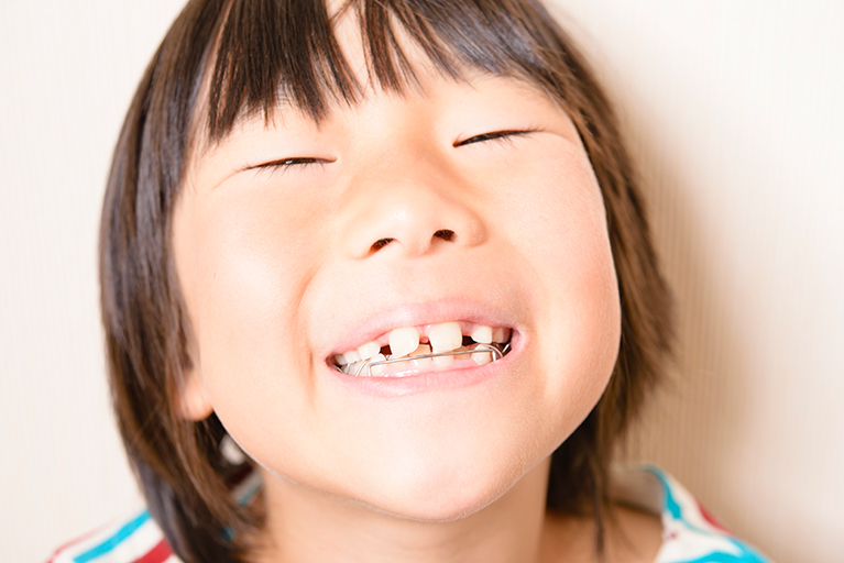 お子様から大人の方まで矯正治療に対応しています